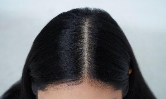 How to Avoid Dandruff | Tips Tricks and Treatments