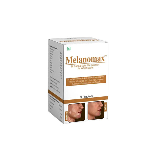 Melanomax Tablets: White Spots & Vitiligo Support Supplement Glein Pharma