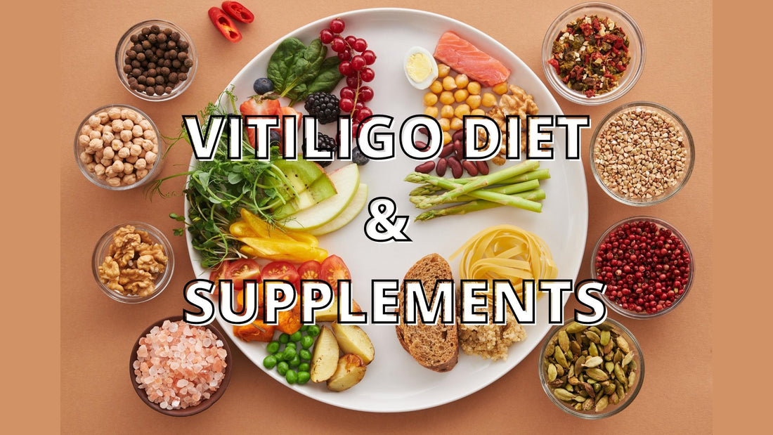 VITILIGO DIET AND SUPPLEMENTS 