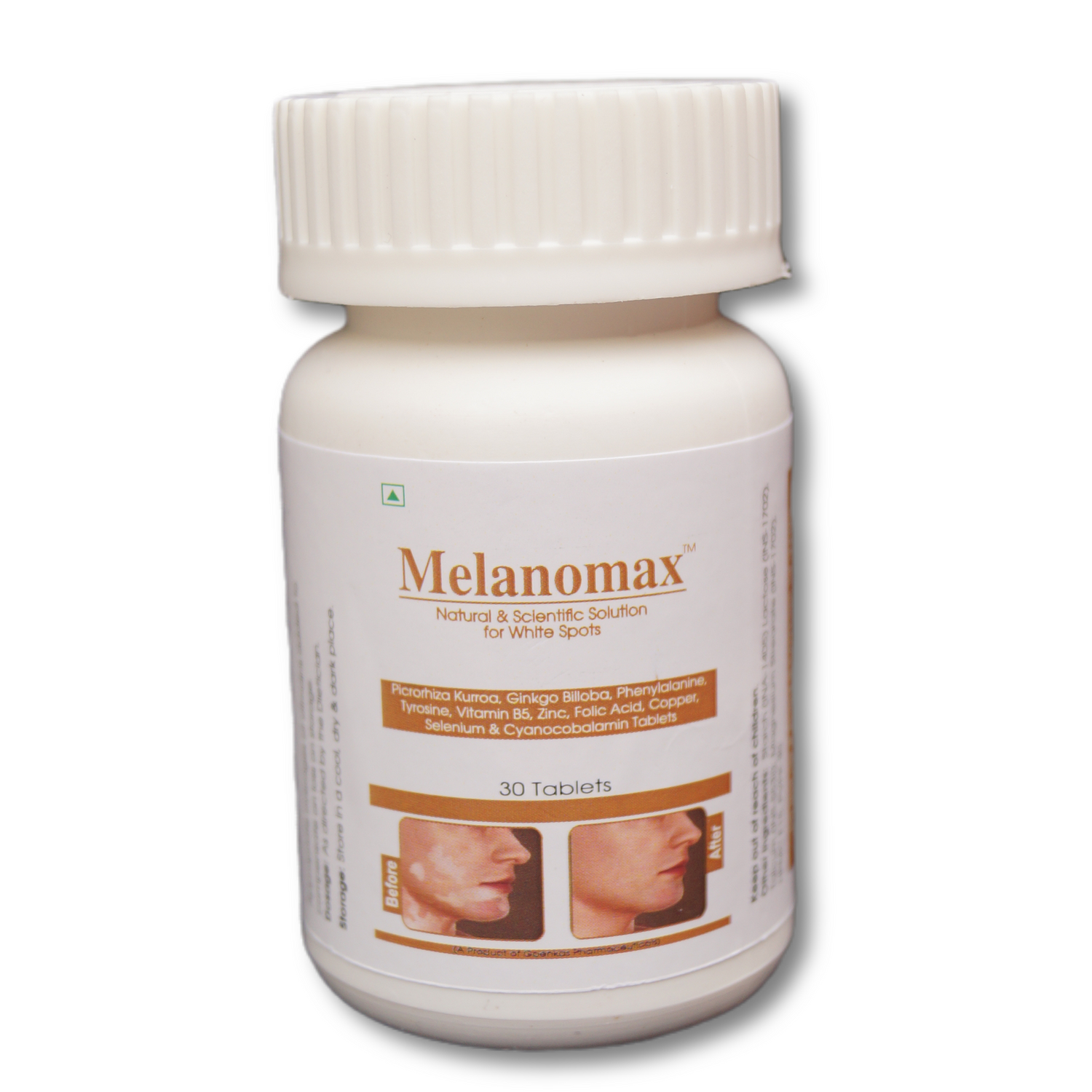 Melanomax - best natural vitamin supplement for White spots and vitiligo management